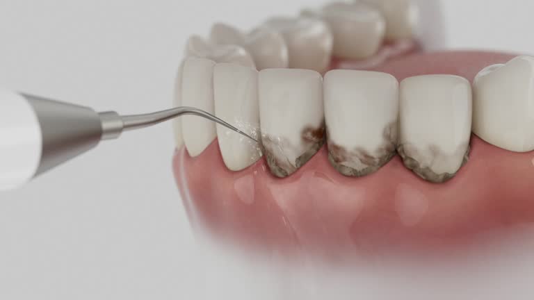 Trusted Root Canal Treatment service in Walkertown, NC - Dentist Open Now